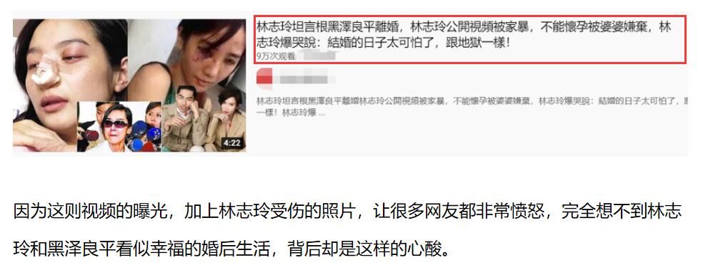 林志玲淤青,林志玲被曝新消息