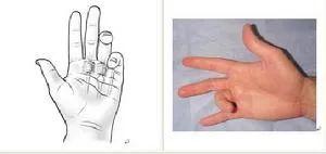 骨头咔咔响中医辨证,谈骨论筋肱骨