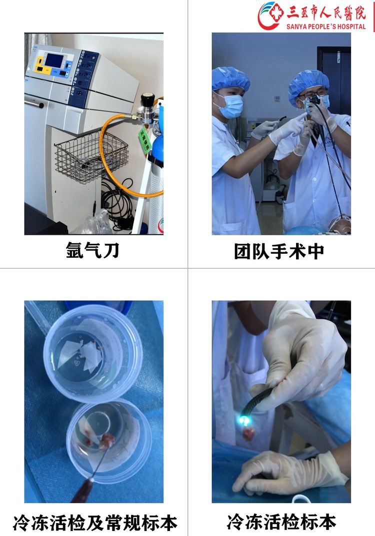 新技术作内核精诚服务患者——三亚市人民医院呼吸内科医疗团队成功开展我省首例支气管镜下冷冻活检术