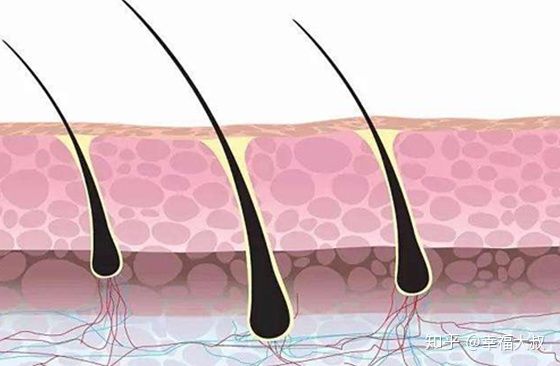 什么比脱发还严重？毛囊退化，毛囊闭合，毛囊萎缩都有什么区别？
