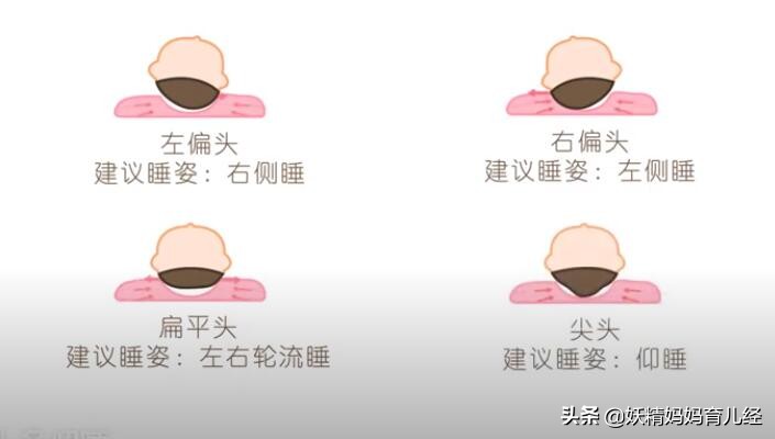 宝宝头型睡凹了怎么矫正,婴儿头型睡扁了纠正方法