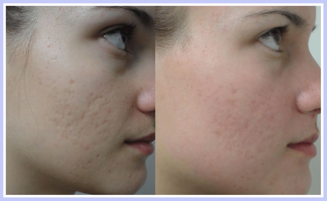 如果被祛痘机构坑了怎么办,我被私立医院骗了怎么办