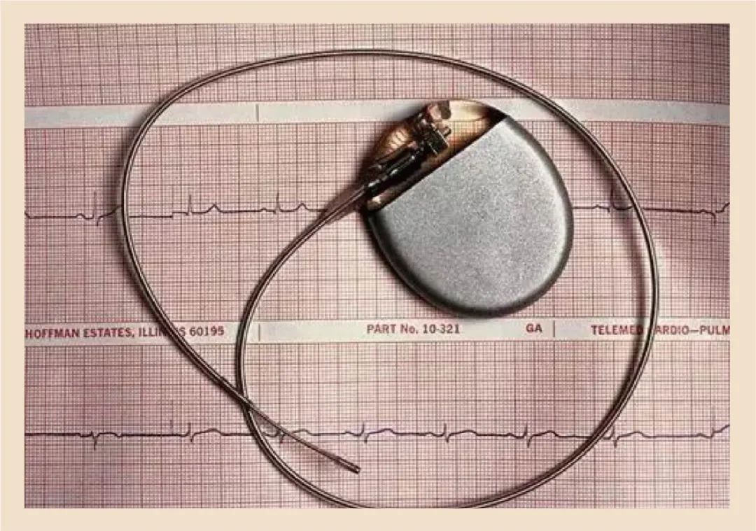 阜外医院主任医师心内科专家,阜外医院华伟医生做房颤怎么样
