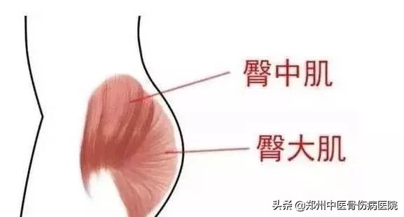 走路摇晃的元凶——臀中肌，看推拿师如何精准治疗？