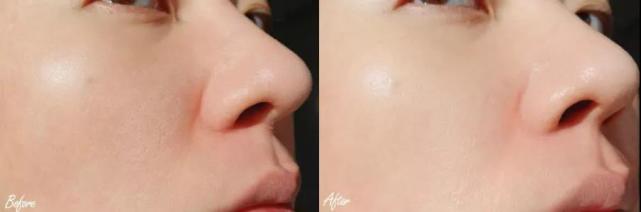 排名第一的胶原蛋白精华,类人胶原蛋白精华推荐