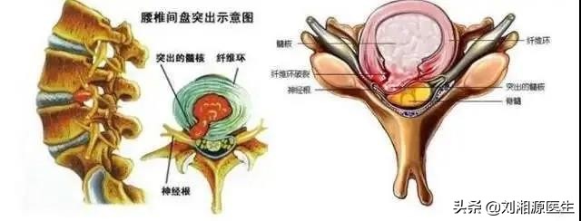 免疫相关不良妊娠诊断指南,免疫治疗不良妊娠的方法