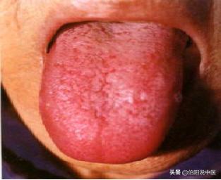 我38岁一直痛经怎么治,我与爷爷学中医养生