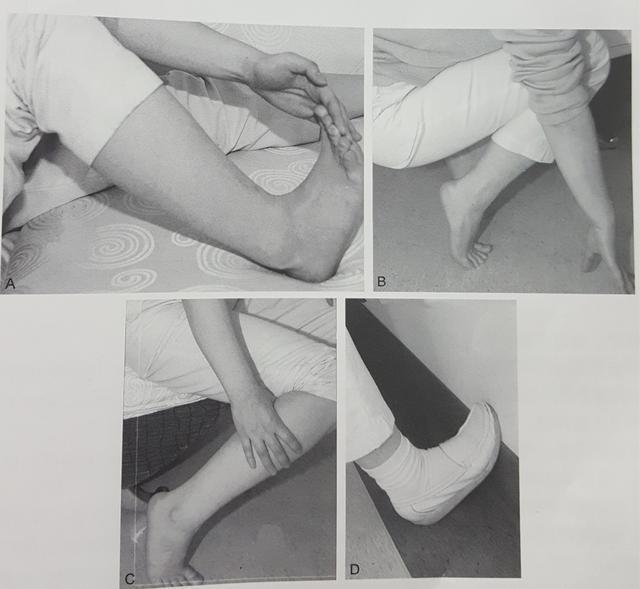 骨刺外翻什么症状,骨刺会导致拇指外翻吗