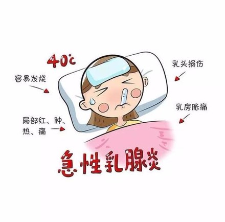 急性乳腺炎可以喂奶吗,急性乳腺炎的按摩手法