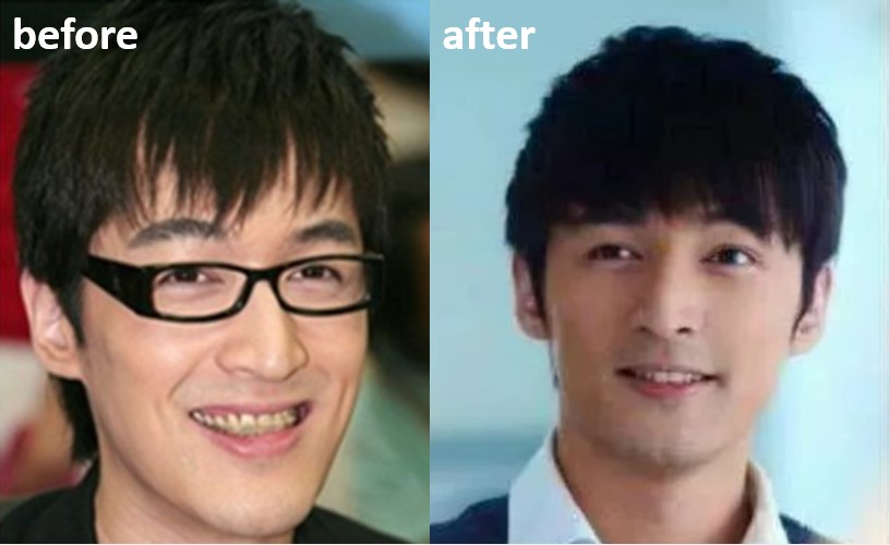 胡歌和刘涛谁的脸更好看,刘涛胡歌牙