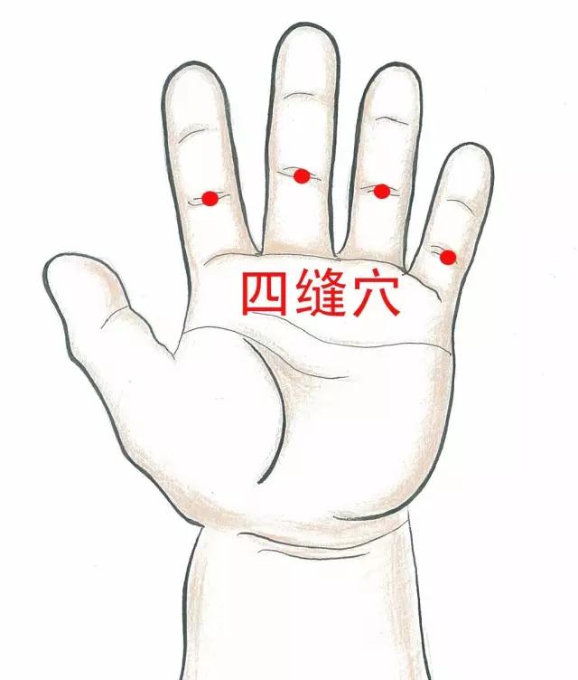 小儿推拿处理积食发烧,小儿推拿积食发烧效果好吗