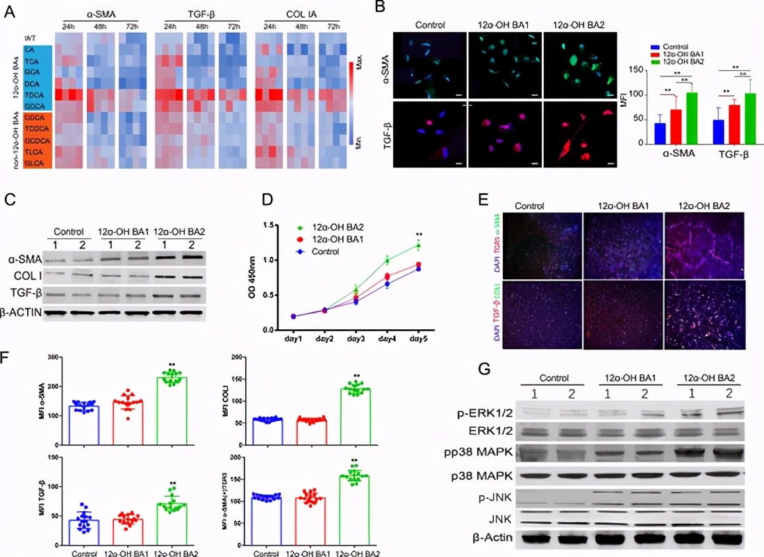 胆汁酸代谢障碍发生机制,胆汁酸代谢和脂质代谢
