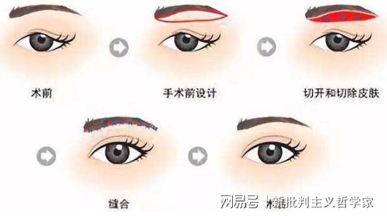 名医专访丨上海交通大学医学院附属同仁医院许瑾：面部美容整形