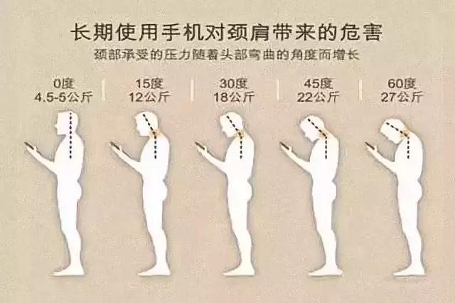 低头玩手机一天脖子疼的缓解办法,低头看手机久了脖子痛怎么缓解