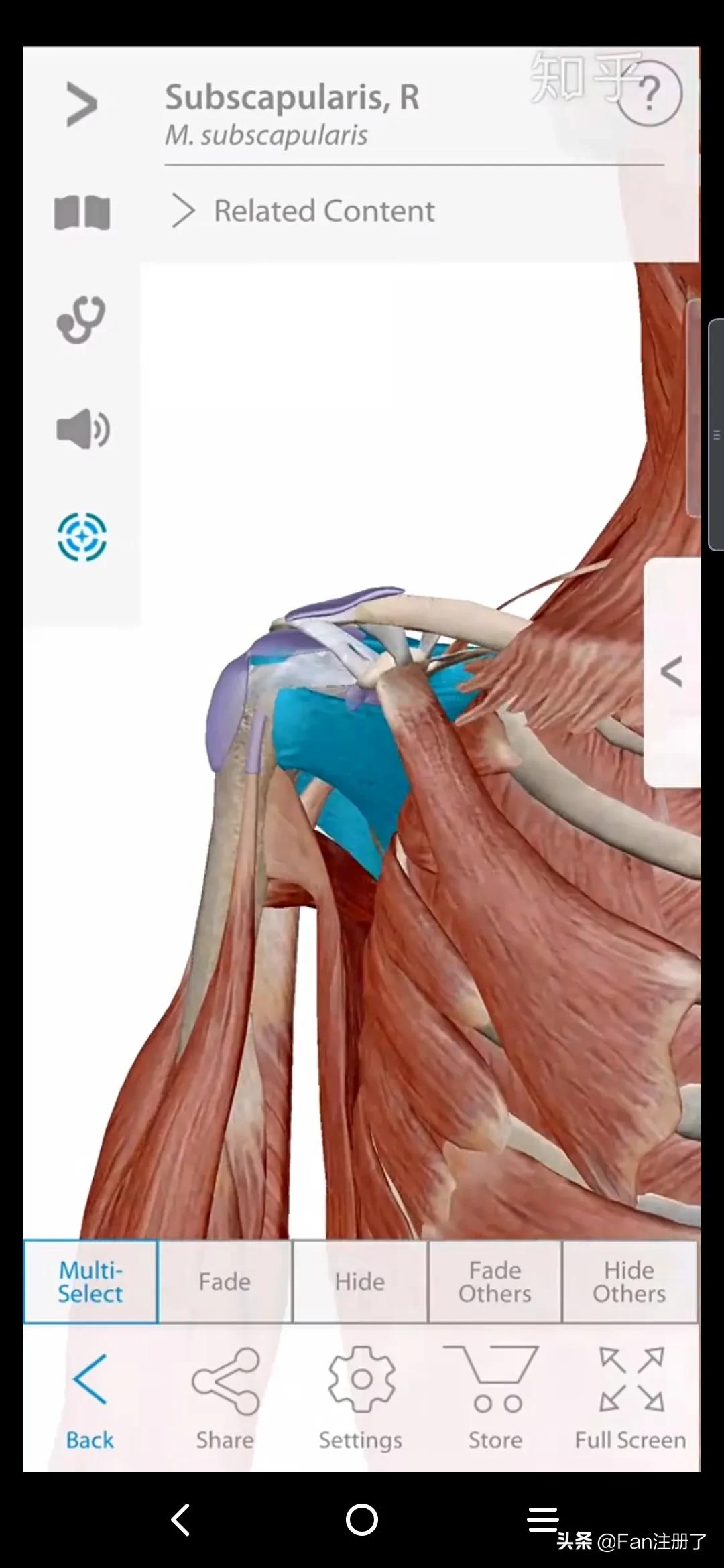 肩痛肩袖损伤针刀治疗,肩痛肩关节活动受限用什么药