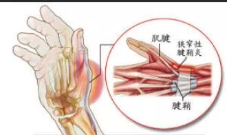 新手妈妈的困惑全集,新手妈妈的烦恼完整版