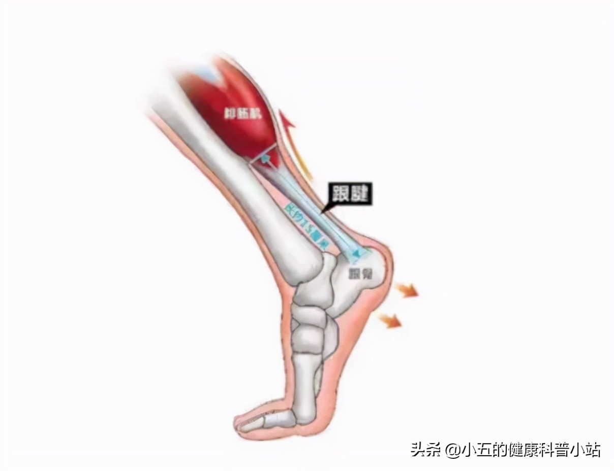 足跟痛疾病诊断与治疗要点,足跟痛跟哪些疾病有关