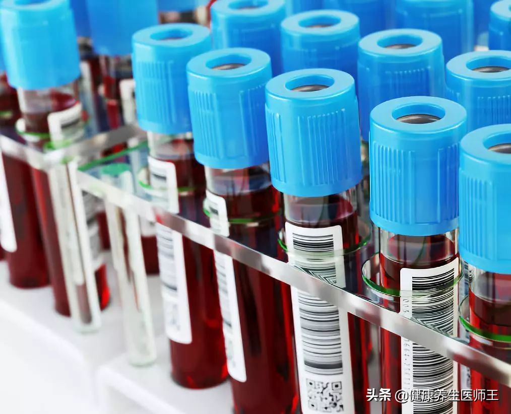 肿瘤标志物3项能查什么,肺肿瘤标志物怎么检查