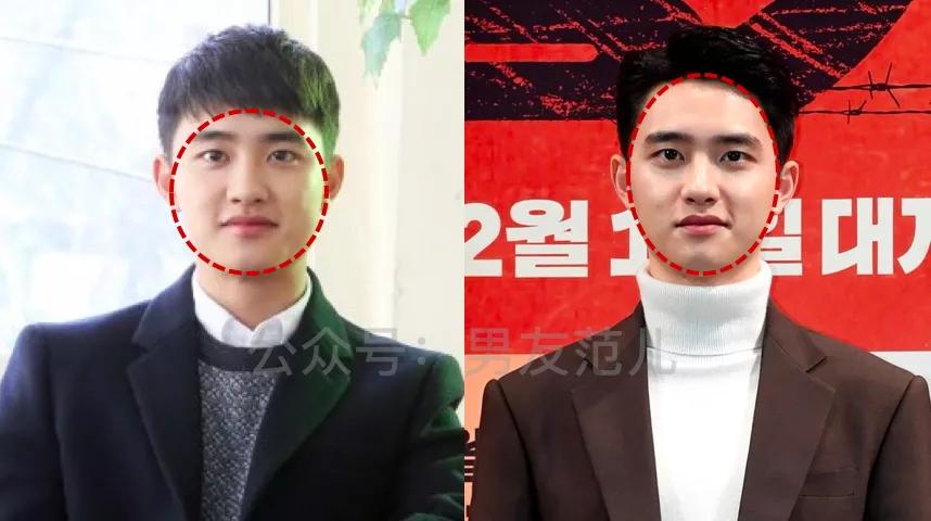 娃娃脸不好看怎么办,娃娃脸不够圆怎么办