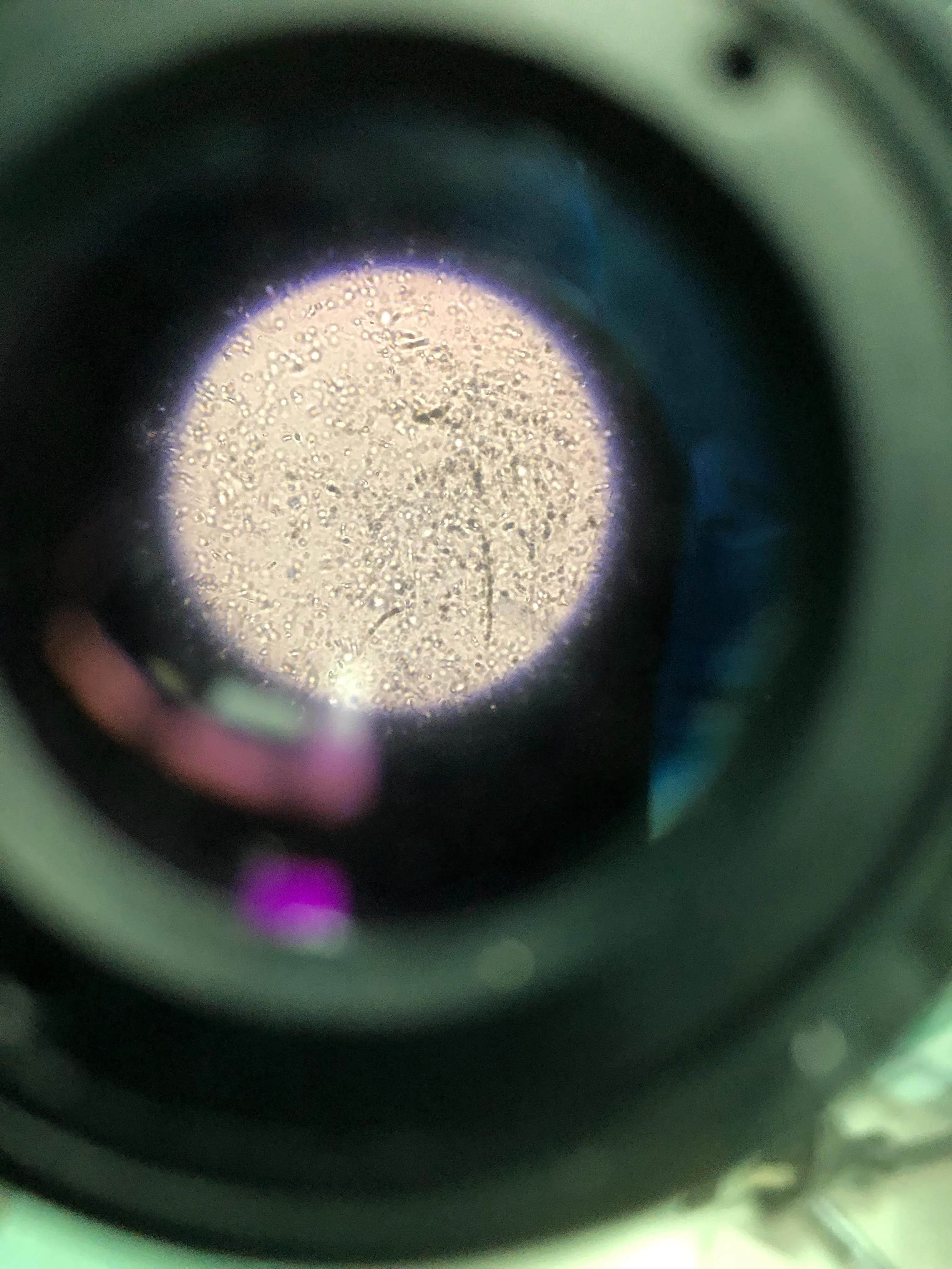 男性输精管梗阻微创手术成功率,男科显微手术有哪些