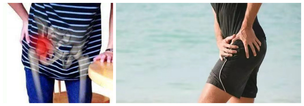 胯骨疼是不是骨折,胯骨疼是什么原因股骨头坏死