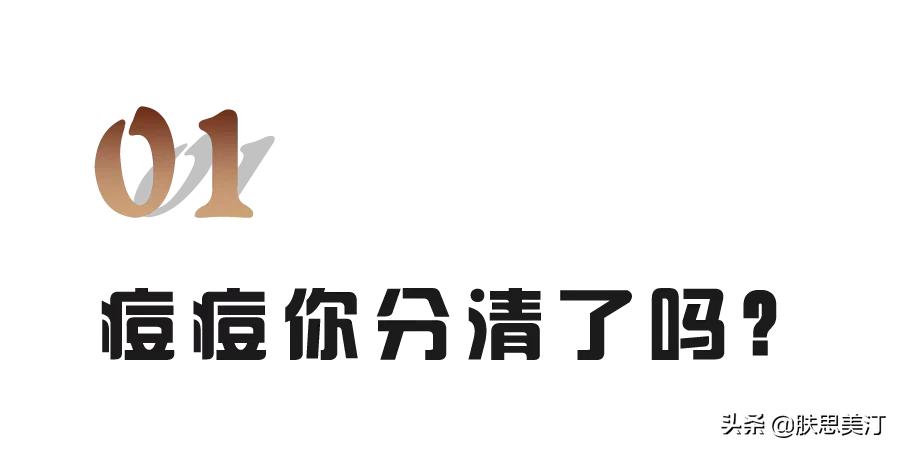战痘消好用吗,战痘多年毫无成效你真的了解它吗