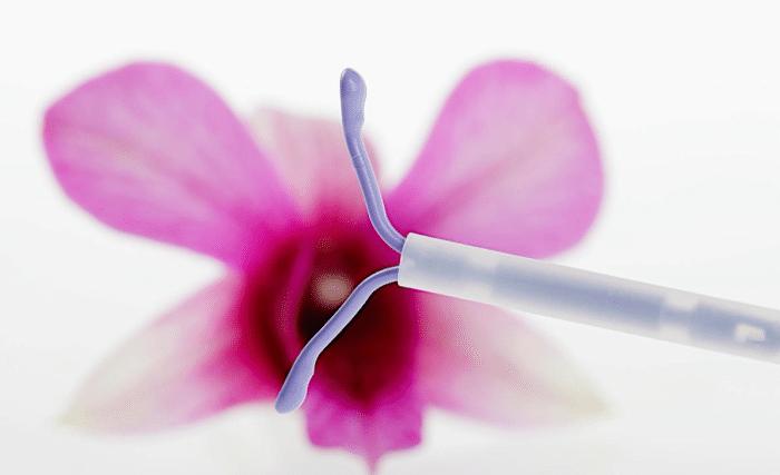 女子上了节育环会腰疼吗,女人上节育环会变胖吗