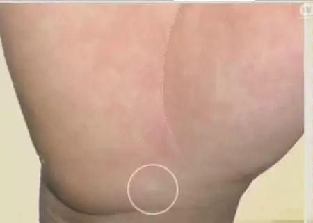 手诊10种常见病从手上就能看出来,手形看健康