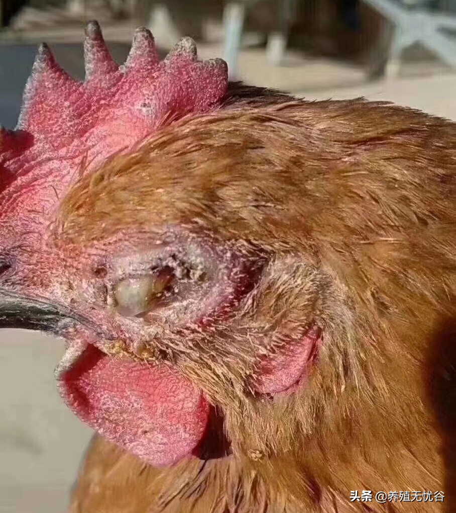 由支原体感染引起的咳嗽怎么治,呼吸道支原体怎么能彻底治好