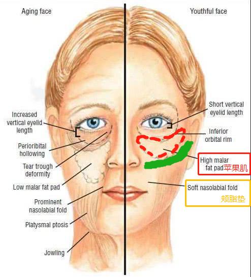 张歆艺用的什么填充脸部,张歆艺填充脸部前后对比