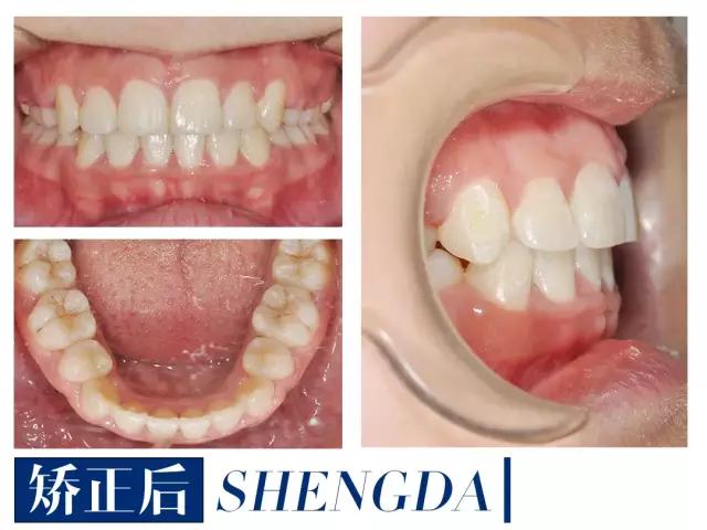 山西“爱马仕”级别齿科医院!get明星同款笑容