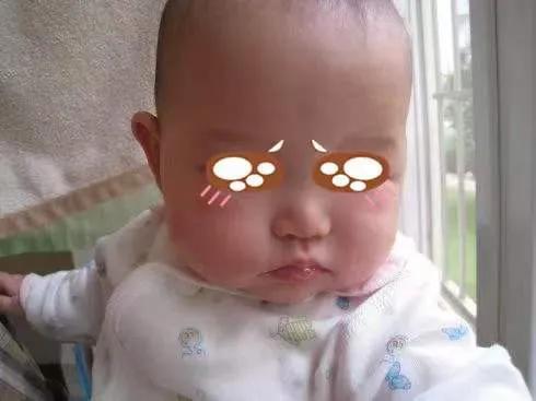 春天,宝宝皮疹的高发期!家长看看怎么辨别皮疹和护理!