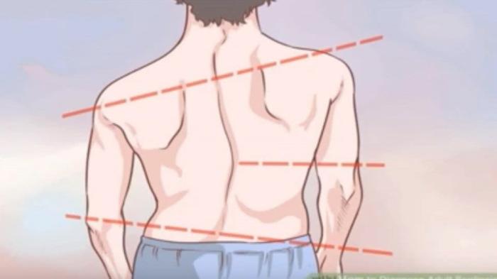 高低肩体态不好可以去练普拉提,高低肩腰间盘突出体态怎么矫正