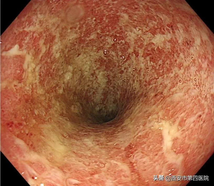 健康中国2023重大行动,健康中国行动是真是假