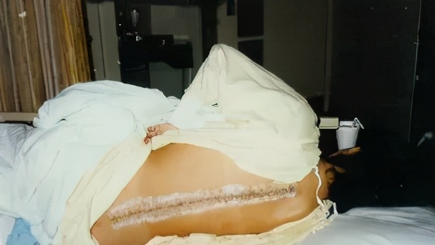 征服美国的“黑寡妇”正在用生命做赌注，同病魔展开新的比赛