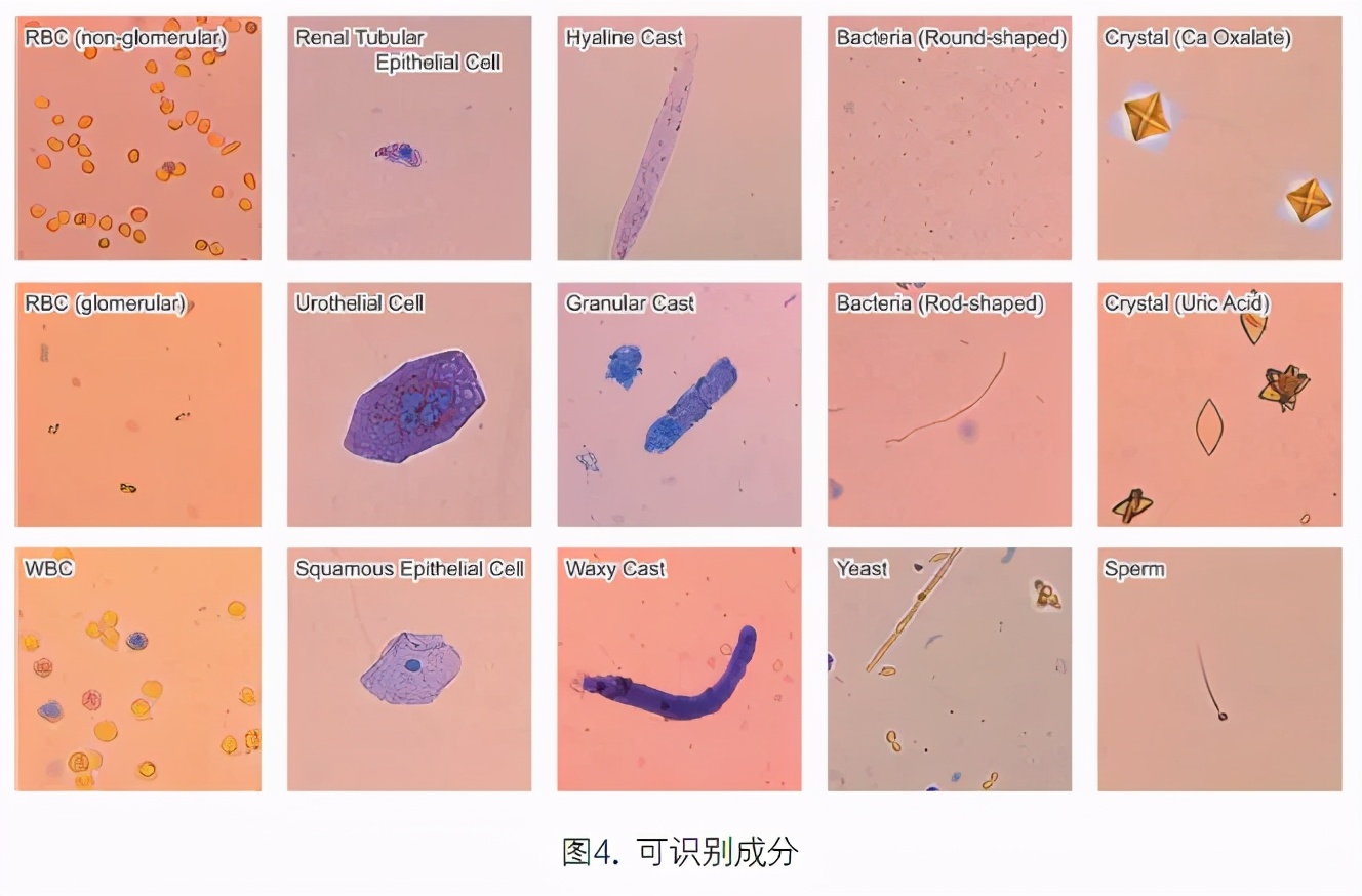 尿液有形成分分析的应用进展,尿液染色方法