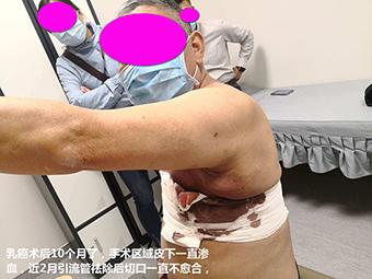 追问医院排行榜:已经死的,能不死吗?活受罪的,到底谁能治?