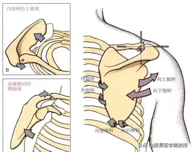 30多岁得了五十肩怎么办,五十肩一定是50岁发病吗