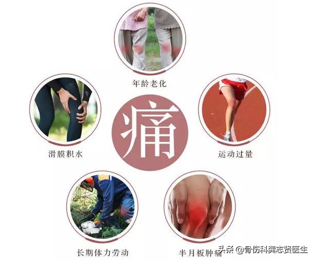 膝关节痛是小事再不重视就晚了,辟谣半月板三度损伤