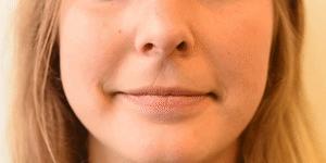 facs的全称是什么,facs面部编码系统