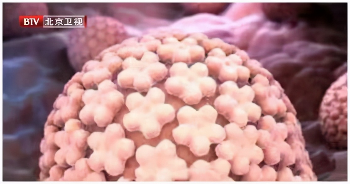 针眼、跖疣、毛囊炎，化脓了怎么办？千万别挤