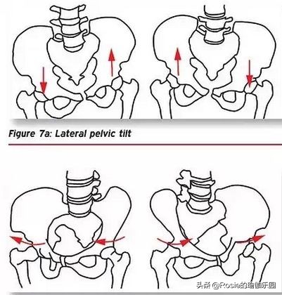 走路鞋子外侧磨损严重如何矫正,如何避免走路时磨鞋外侧