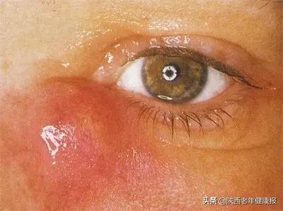 宝宝视力检查异常是什么意思,宝宝眼睛的异常现象