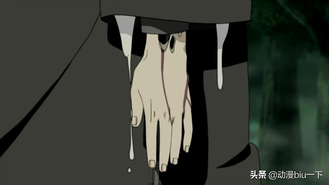 断手佐助,佐助为什么不安装义肢