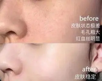 48岁袁咏仪面霜,袁咏仪和李佳琦哪个好