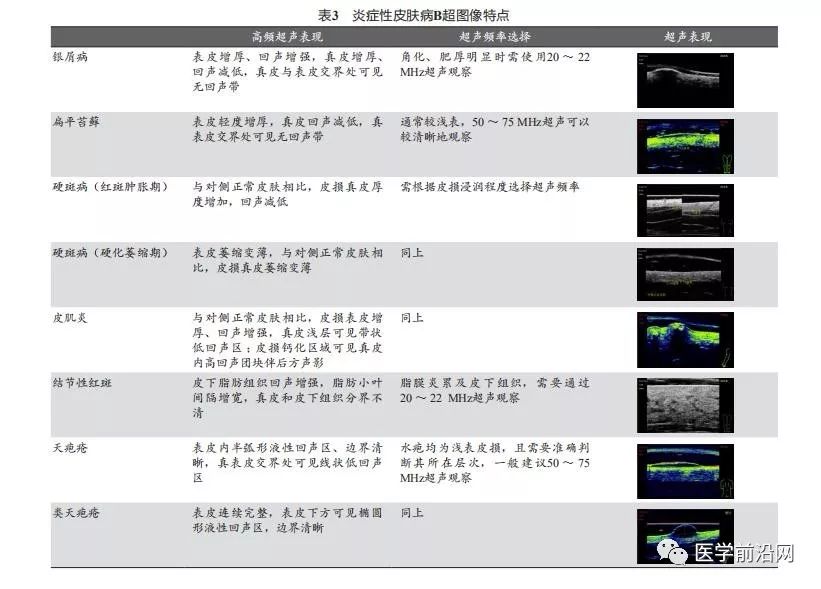 常见皮肤病高频皮肤超声诊断专家共识全文发布