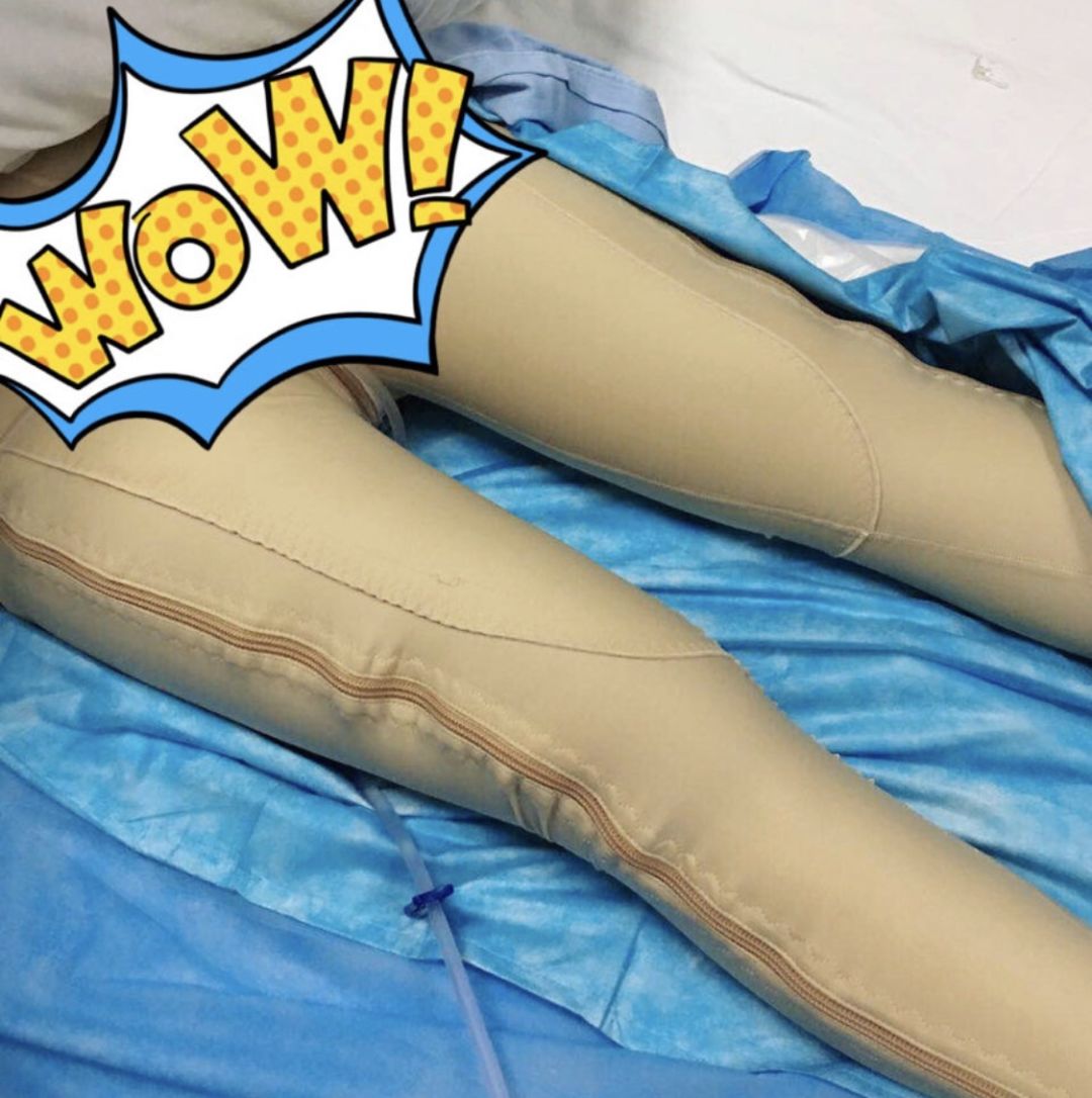 郑爽同款漫画腿不动刀也能get？吴昕的萝卜腿有救了