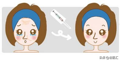 玻尿酸精华水对皮肤的作用与功效,玻尿酸注射之面部提升科普指南篇