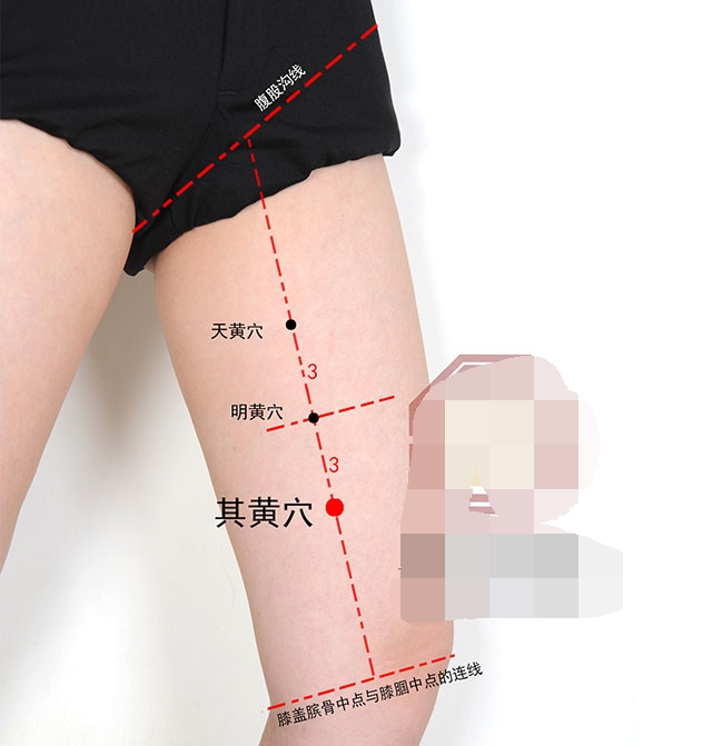 耳朵经常嗡嗡响可以中医针灸吗,耳朵乳突炎能针灸治疗治愈吗