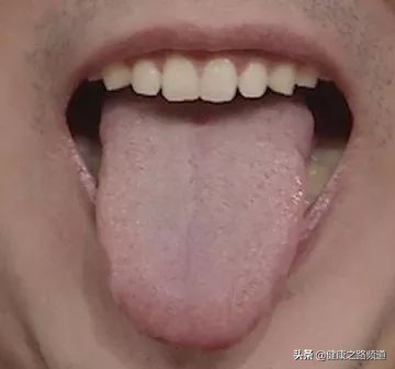 黄芪能快速增强人体抵抗力!但只有这种人能用,快看你适不适合